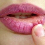 por que os labios ficam ressecados