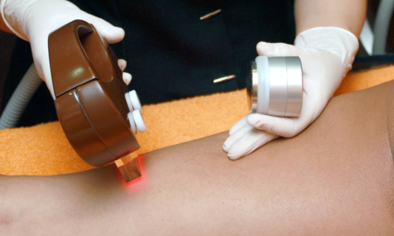 Como Funciona A Depilação A Laser Zona Curiosa