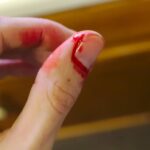 por que a pele debaixo das nossas unhas e tao sensivel