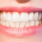 por que nossos dentes tem formas e tamanhos diferentes