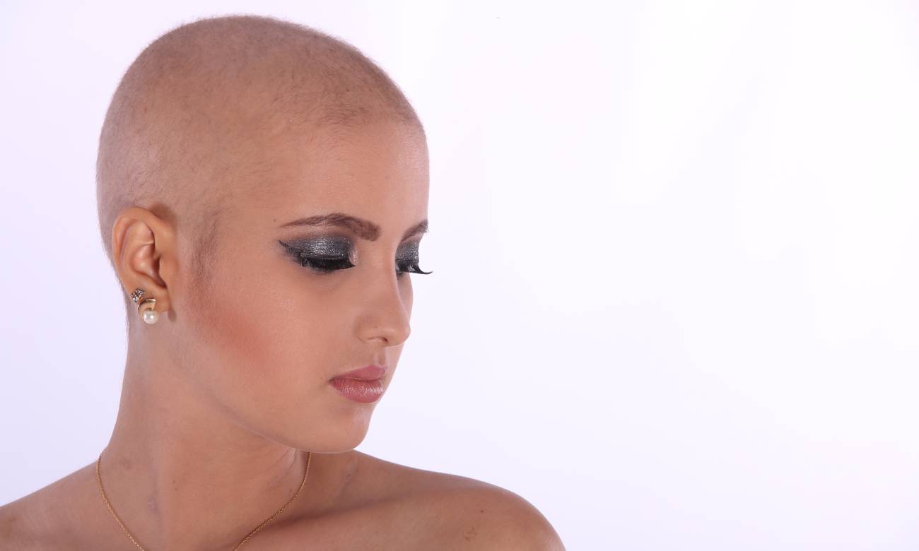 Queda de cabelo após quimioterapia