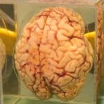 por que o cerebro humano tem tantas dobras