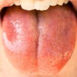 SALIVA CAPA