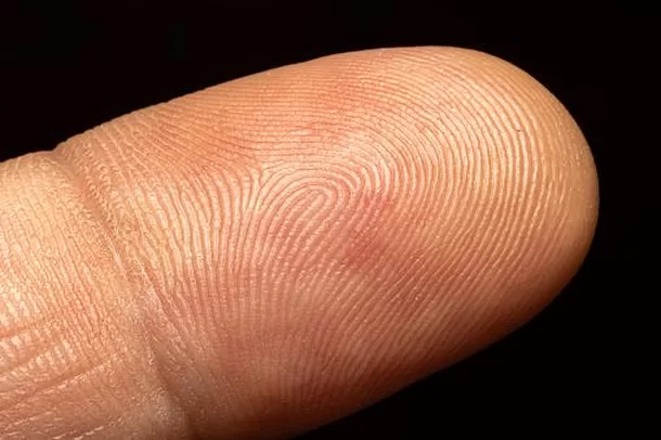 A Singularidade das Impressões Digitais em Gêmeos Idênticos: Um Fenômeno Fascinante