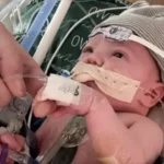 Primeiro transplante parcial de coracao em bebe segue crescendo com ele um ano depois