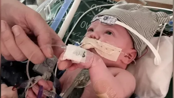 Primeiro transplante parcial de coracao em bebe segue crescendo com ele um ano depois