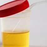 Tiktoker recomenda usar urina para curar a visao. O que a ciencia diz disso